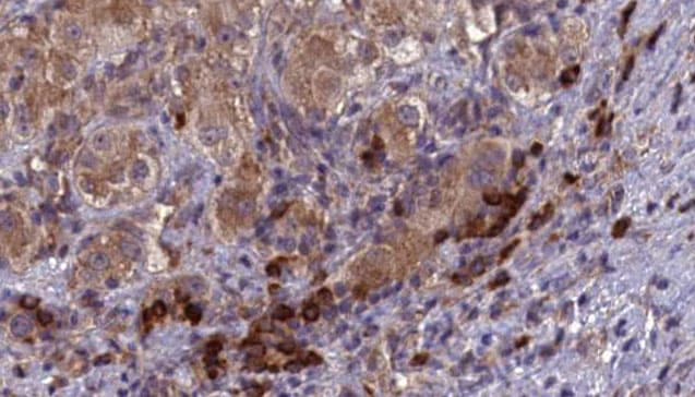 SPAM1 / PH20 Antibody (aa216-244)