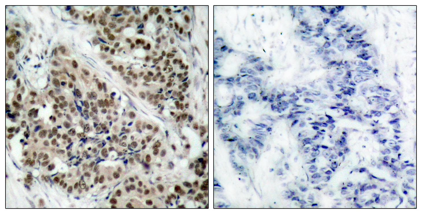 FOXO1 / FKHR Antibody (phospho-Ser256)
