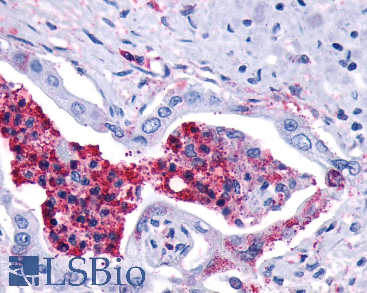 PathPlus™ Polyclonal Rabbit anti-Human LTB4R2 / BLT2 Antibody (C-Terminus, IHC)