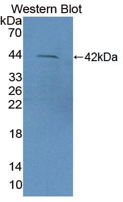 CD3D Antibody (aa19-102, PE)