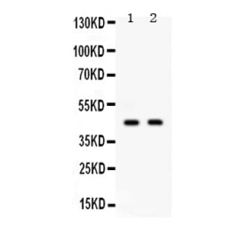 AIM2 Antibody (aa14-215)