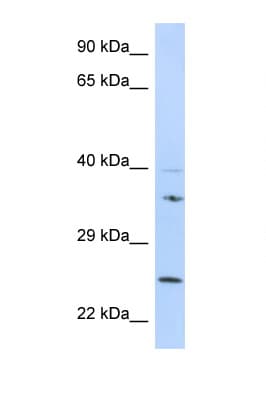 GRB2 Antibody (N-Terminus)