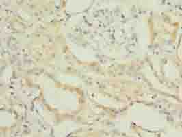 FBXO28 Antibody
