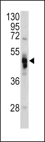 Polyclonal Rabbit anti-Human GLA / Alpha Galactosidase Antibody (aa83-112, IHC, IF, WB)