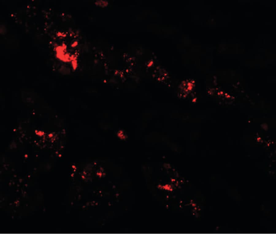 Polyclonal Rabbit anti-Human SLC39A1 Antibody (IHC, IF, WB)