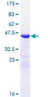 Human NCALD / Neurocalcin Delta Protein (Recombinant GST)