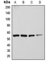 ATP6V1H Antibody (Internal)
