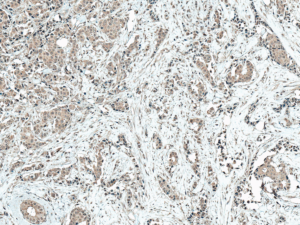 CREBBP / CREB Binding Protein Antibody (Biotin)