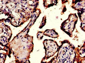 ITGA5/Integrin Alpha 5/CD49e Antibody