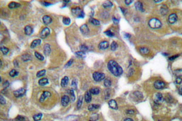 KRT7 / CK7 / Cytokeratin 7 Antibody (Leu451)