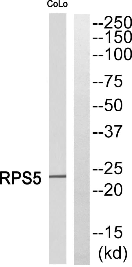 RPS5 / Ribosomal Protein S5 Antibody