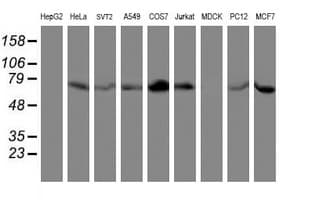 LIMK1 / LIMK Antibody (clone OTI3H6)