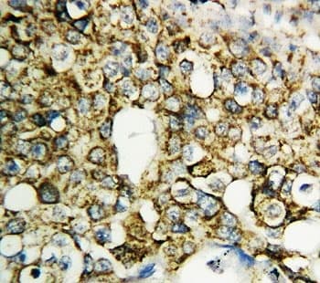 Polyclonal Rabbit anti-Human TFPI2 Antibody (aa170-186, IHC, WB)