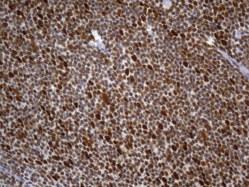 MSH2 Antibody (aa1-304, clone UMAB259)