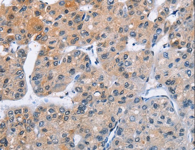 ATXN1 / SCA1 Antibody