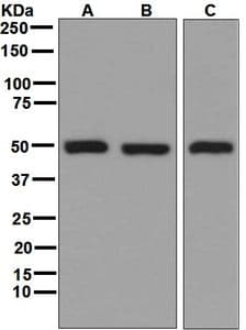 IHC-plus™ GSS / Glutathione Synthetase Antibody (Internal, clone EPR6563)
