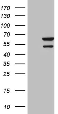 CDY2B Antibody (clone OTI4B8)