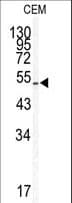 KLF5 / BTEB2 Antibody (aa127-156)