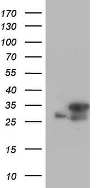 C14orf166 Antibody (clone OTI1E5)