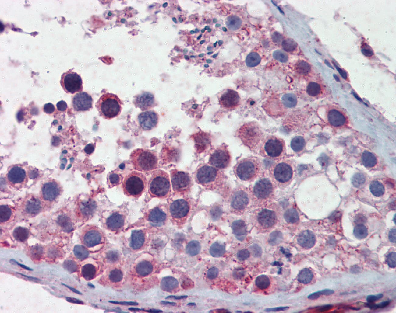SMC3 / HCAP Antibody (aa1051-1100)