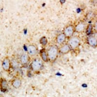 Polyclonal Rabbit anti-Human VPS37A Antibody (IHC, IF, WB)