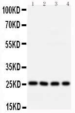 BCL10 / BCL-10 Antibody (aa35-51)