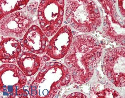 Polyclonal Rabbit anti-Human ANXA4 / Annexin IV Antibody (aa163-258, IHC, WB)