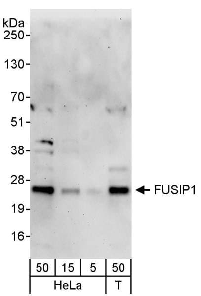 IHC-plus™ Polyclonal Rabbit anti-Human SRSF10 / FUSIP1 Antibody (aa133-183, IHC, WB)