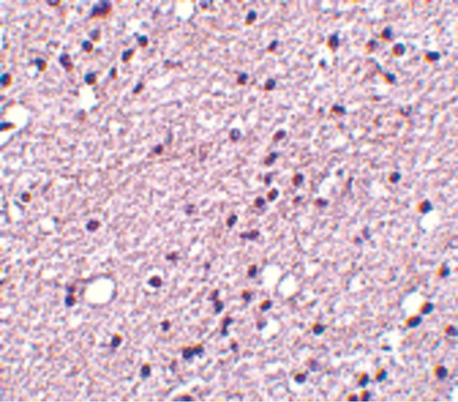 TACR3 / NK3R Antibody