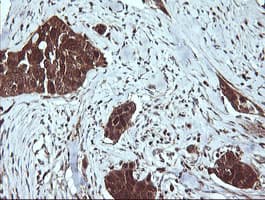LGALS3 / Galectin 3 Antibody (clone OTI1A2)