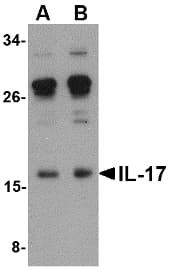 IL17A Antibody