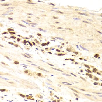 PRPF3 Antibody