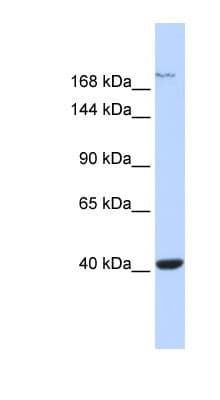 GRIN2A / NMDAR2A / NR2A Antibody (aa1115-1164)