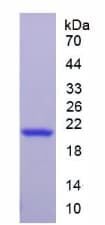 Mouse FFAR3 / GPR41 Protein (Recombinant His-SUMO, N-terminus)