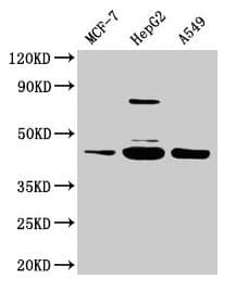 SERPINB1 Antibody (aa1-379)