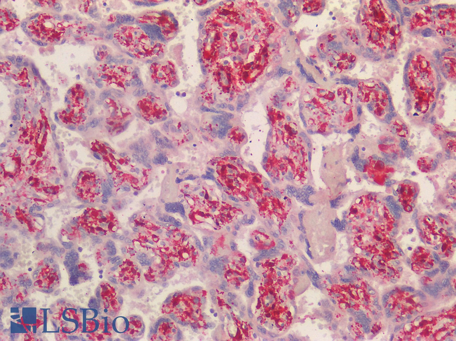 IHC-plus™ TAGLN / Transgelin / SM22 Antibody (C-Terminus)