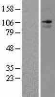 ANO7 / TMEM16G / NGEP Protein (Over-Expression Lysate Myc-DDK (Flag))