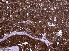 NME1 / NM23 Antibody (clone OTI7E5)