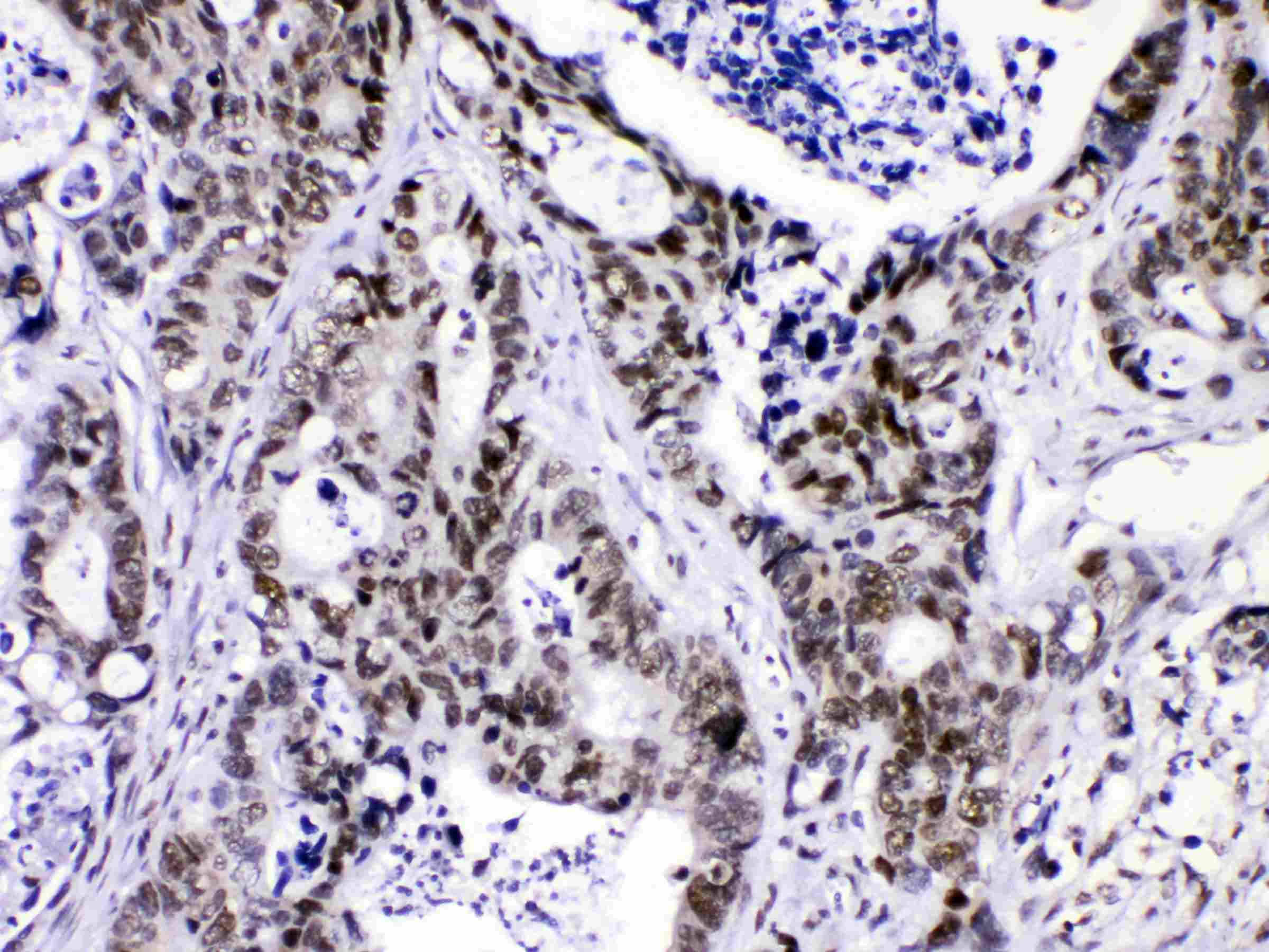 HNRNPF / hnRNP F Antibody