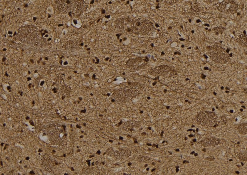 TBX15+18 Antibody