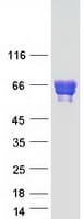 Human CARD9 Protein (Recombinant Myc-DDK (Flag))