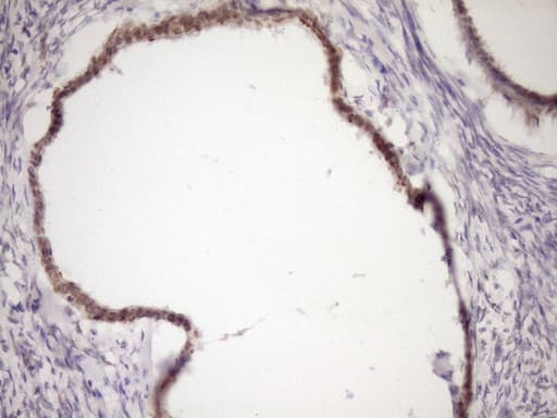 Monoclonal Mouse anti-Human WTAP Antibody (clone OTI12G6, Carrier-free, aa2-106, IHC, WB)