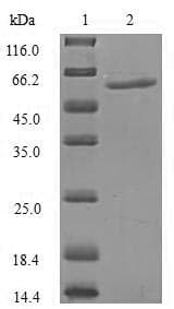Human KPNA1 / Importin Alpha 5 Protein (Recombinant 6His, N-terminus)