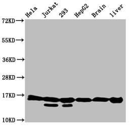 Polyclonal Rabbit anti-Human HIST1H3A Antibody (IHC, WB)