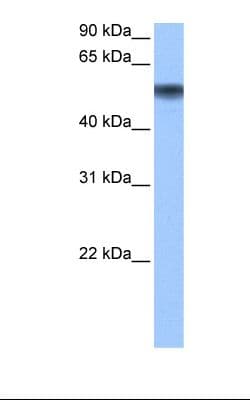 Polyclonal Rabbit anti-Human METAP2 Antibody (aa95-144, IHC, WB)