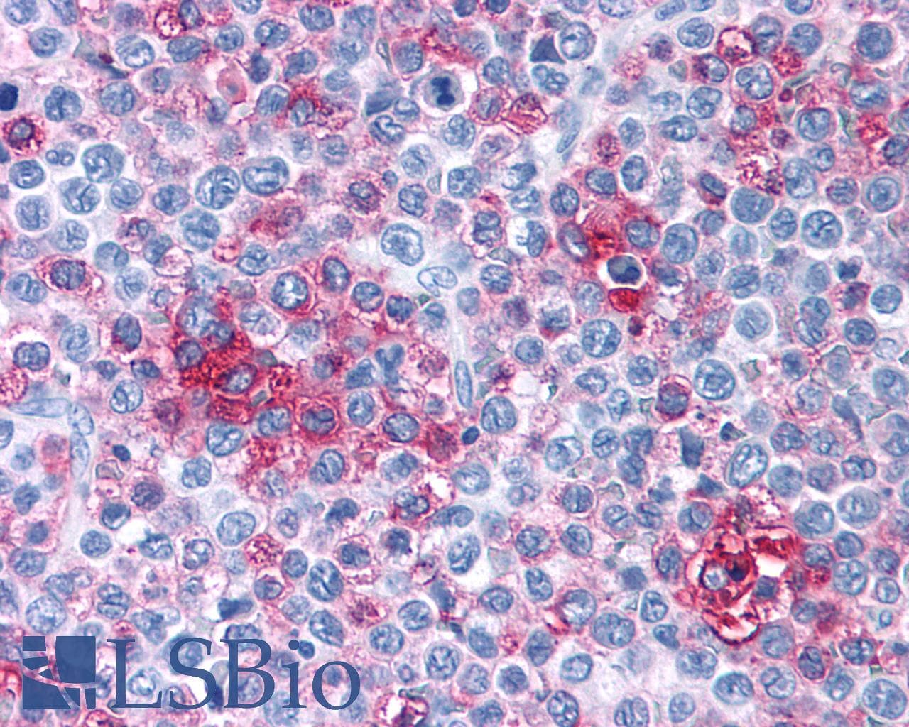 PathPlus™ FZD1 / Frizzled 1 Antibody (N-Terminus)