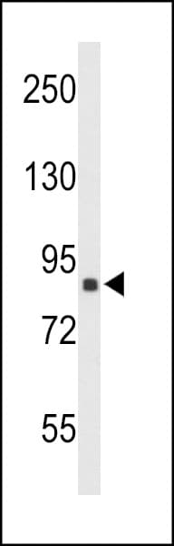 IHC-plus™ Polyclonal Rabbit anti-Human TNPO1 / Transportin 1 Antibody (aa47-74, IHC, WB)