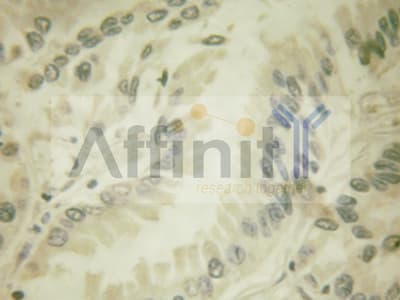 CASP8 / Caspase 8 Antibody