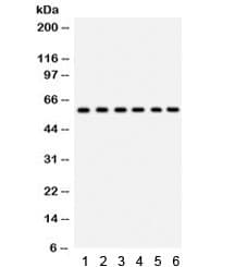 Polyclonal Rabbit anti-Human CYP24 / CYP24A1 Antibody (aa153-514, IHC, WB)