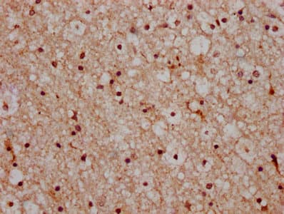 HIST1H2AI Antibody